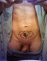 [see him nude]